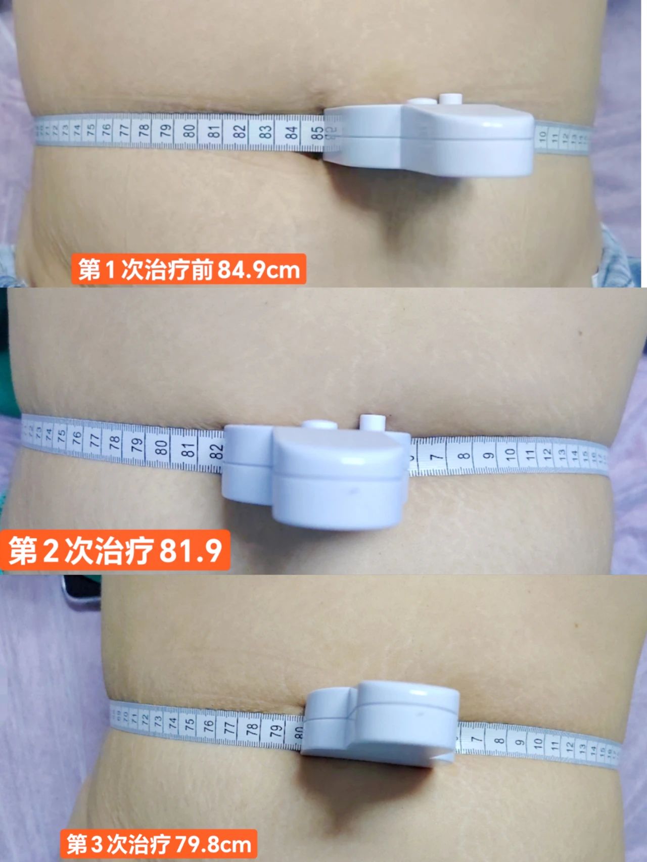 减肥34878956476.jpg