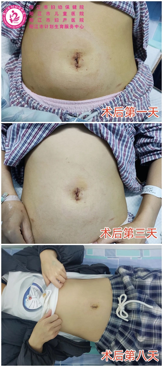 术后恢复对比照.jpg