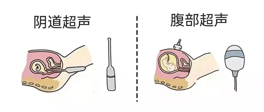 y34895793.png y34895793.png