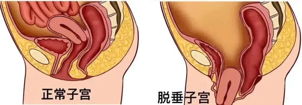 zigongxiasui985674987589.png zigongxiasui985674987589.png