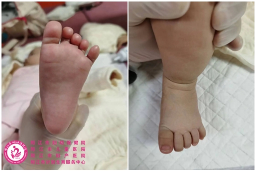 治疗后.jpg